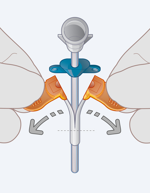 Timeline Chart for Litigation