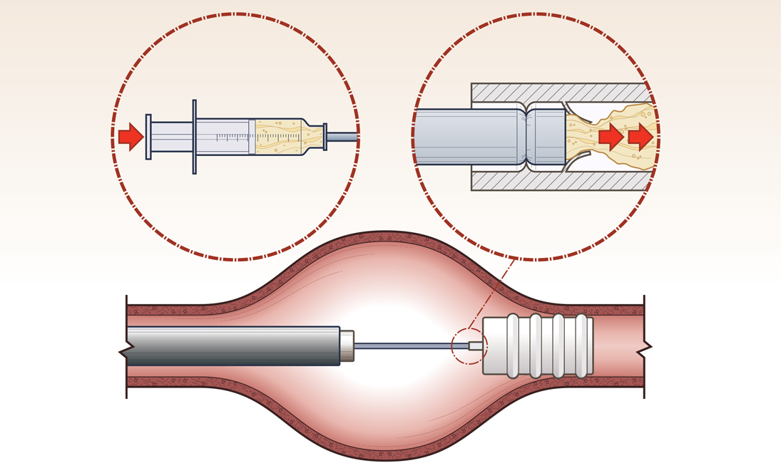 Enlarged Case Timeline